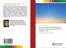 Tuberculose entre Contatos Domiciliares no Município de CAXIAS - MA kitap kapağı