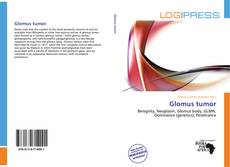 Copertina di Glomus tumor