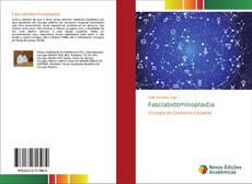 Couverture de Fasciabidominoplastia