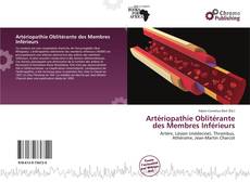 Copertina di Artériopathie Oblitérante des Membres Inférieurs