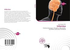 Portada del libro de Infarctus