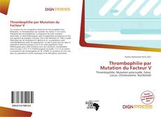 Copertina di Thrombophilie par Mutation du Facteur V