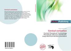 Copertina di Cervical conization