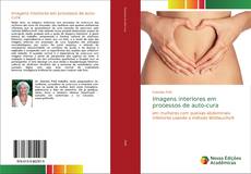 Borítókép a  Imagens interiores em processos de auto-cura - hoz