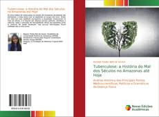 Couverture de Tuberculose: a História do Mal dos Séculos no Amazonas até Hoje