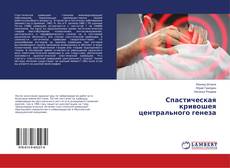 Bookcover of Спастическая кривошея центрального генеза