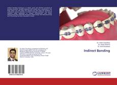 Buchcover von Indirect Bonding