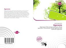 Couverture de Agenesis