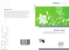 Couverture de Benign tumor