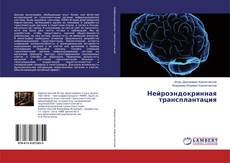 Buchcover von Нейроэндокринная трансплантация