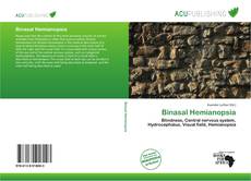 Copertina di Binasal Hemianopsia