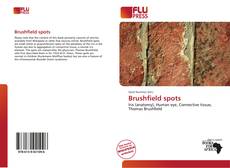 Обложка Brushfield spots