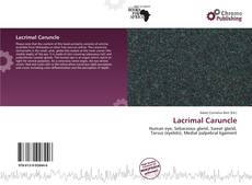 Copertina di Lacrimal Caruncle