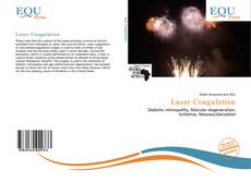 Bookcover of Laser Coagulation
