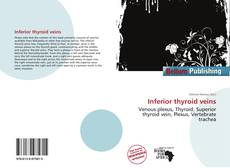 Couverture de Inferior thyroid veins