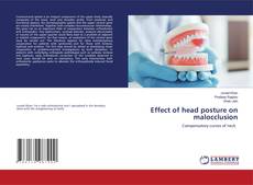 Couverture de Effect of head posture on malocclusion
