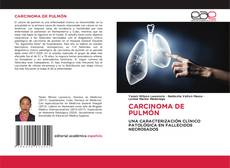 CARCINOMA DE PULMÓN的封面