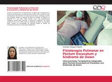 Copertina di Fisioterapia Pulmonar en Pectum Excavatum y Síndrome de Down