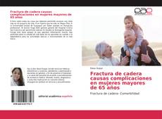 Couverture de Fractura de cadera causas complicaciones en mujeres mayores de 65 años