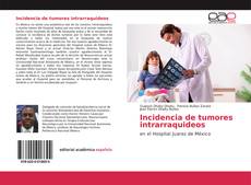 Incidencia de tumores intrarraquideos的封面