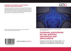 Borítókép a  Lesiones vasculares en las asfixias mecánicas por ahorcadura - hoz