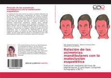 Buchcover von Relación de las asimetrías mandibulares con la maloclusión esquelética