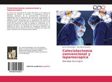 Buchcover von Colecistectomía convencional y laparoscopica