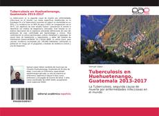 Copertina di Tuberculosis en Huehuetenango, Guatemala 2013-2017
