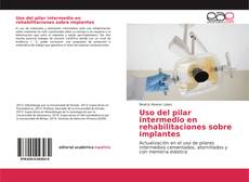 Bookcover of Uso del pilar intermedio en rehabilitaciones sobre implantes