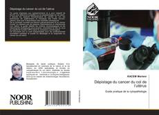 Bookcover of Dépistage du cancer du col de l’utérus