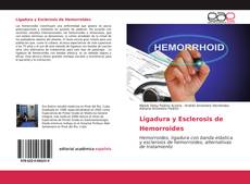 Portada del libro de Ligadura y Esclerosis de Hemorroides