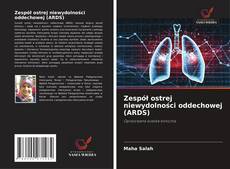 Bookcover of Zespół ostrej niewydolności oddechowej (ARDS)