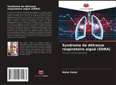 Bookcover of Syndrome de détresse respiratoire aiguë (SDRA)