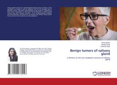 Copertina di Benign tumors of salivary gland