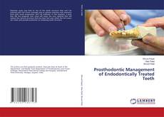 Copertina di Prosthodontic Management of Endodontically Treated Teeth