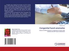 Copertina di Congenital hand anomalies