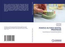 Copertina di PONTICS IN FIXED DENTAL PROSTHESIS