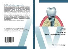 Copertina di Geführte Knochenregeneration