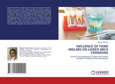 Buchcover von INFLUENCE OF THIRD MOLARS ON LOWER ARCH CROWDING