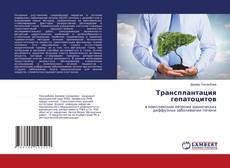 Buchcover von Трансплантация гепатоцитов