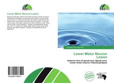 Copertina di Lower Motor Neuron Lesion