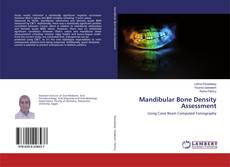 Buchcover von Mandibular Bone Density Assessment