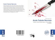 Bookcover of Acute Tubular Necrosis