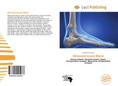 Bookcover of Atrioventricular Block