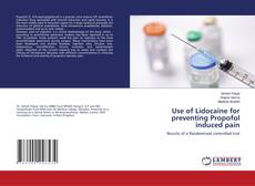 Buchcover von Use of Lidocaine for preventing Propofol induced pain