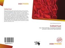Copertina di Colloid Cyst