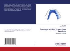 Bookcover of Management of Lower Jaw Fracture