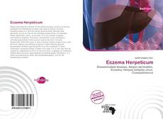 Portada del libro de Eczema Herpeticum