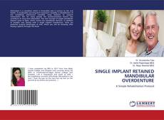 Buchcover von SINGLE IMPLANT RETAINED MANDIBULAR OVERDENTURE