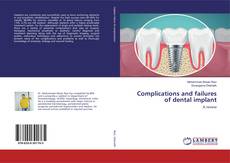 Buchcover von Complications and failures of dental implant